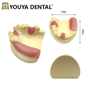Модел верхнечелюстного на импланта с меки венците, обучение модел на имплант за практикуване на зъбен техника, Обучение модел