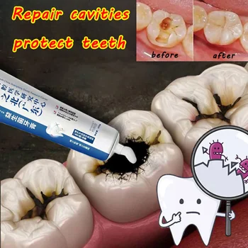 Паста за зъби Sdotter, осветляющая, лечебното паста за зъби, лечебното зъби, Избелване на зъби, Отстраняване на зъбната плака, Избелване на кариозен кухини, жълто
